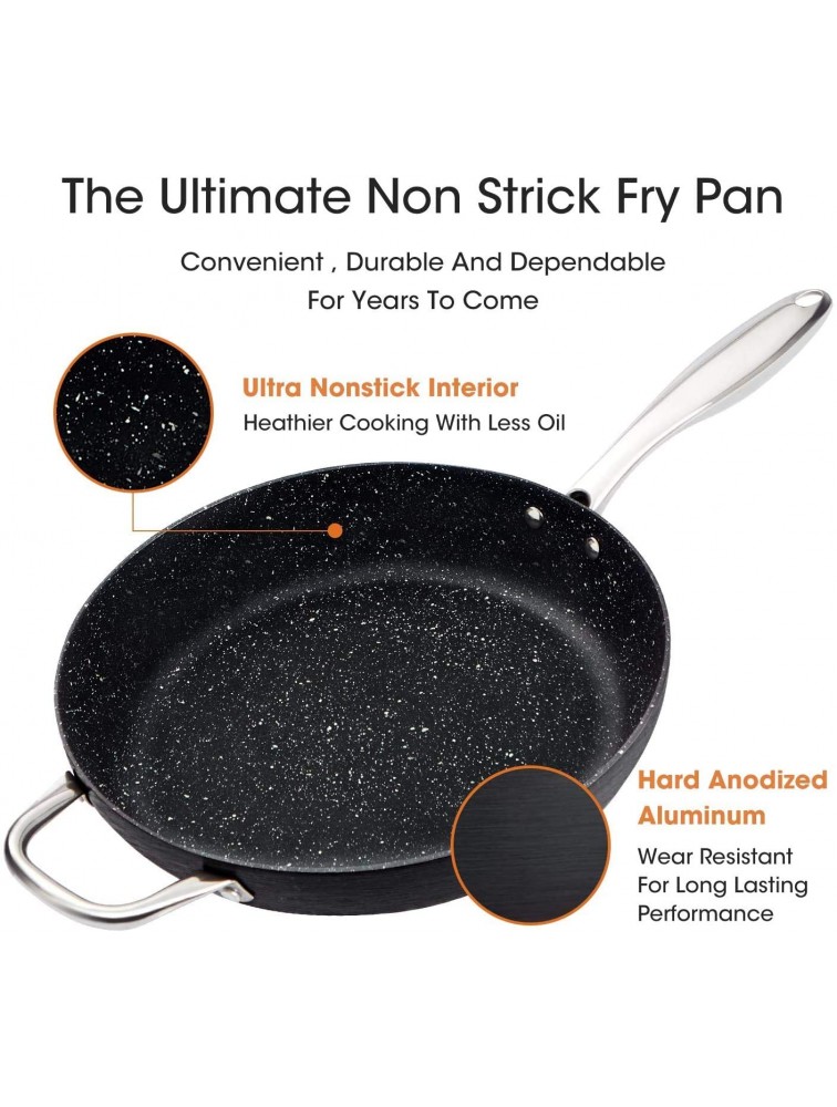MICHELANGELO Hard Anodized Frying Pan Nonstick 12 Inch Frying Pan with Lid Nonstick Skillet with Lid Large Frying Pan with Stainless Steel Handle Non Stick Fry Pan with Lid Induction Compatible - BXQ94QRGS